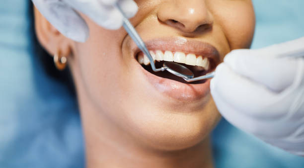 Best Emergency Dentist for Lost Fillings or Crowns in Spring Glen, UT